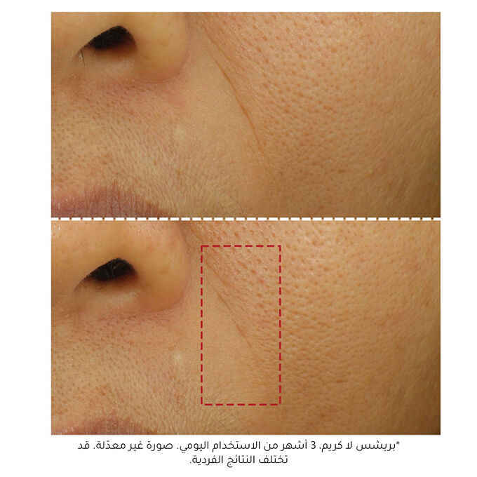 كريم بريشس المرطب