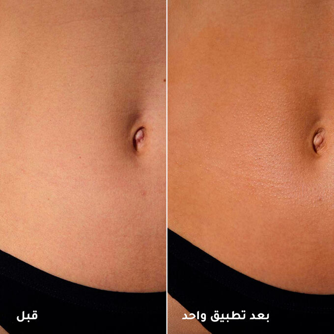 جل التسمير الفوري